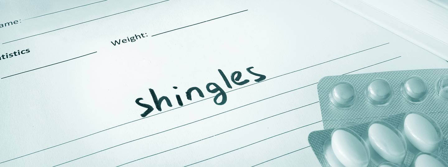 shingles-treatments