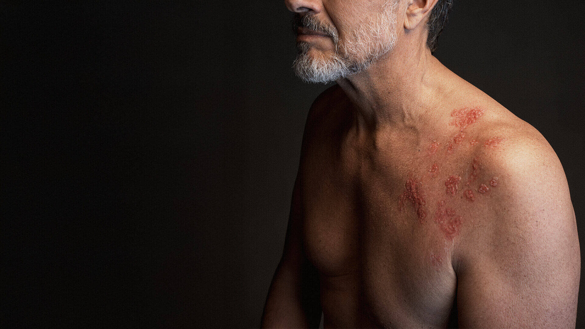 CAUSES, SYMPTOMS AND COMPLICATIONS_New